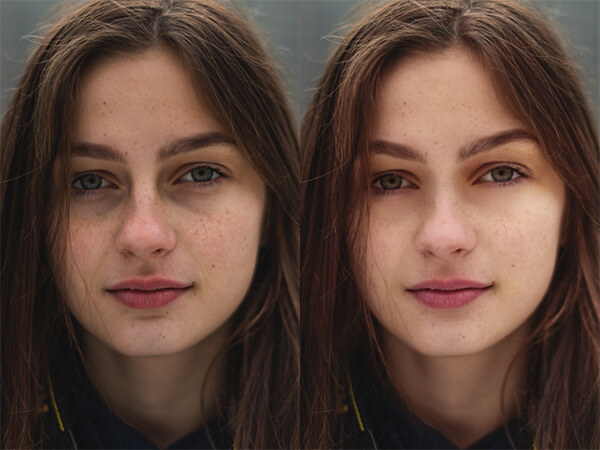 Montagem com 2 fotos de uma mulher com sardas mostrando o antes e depois. 