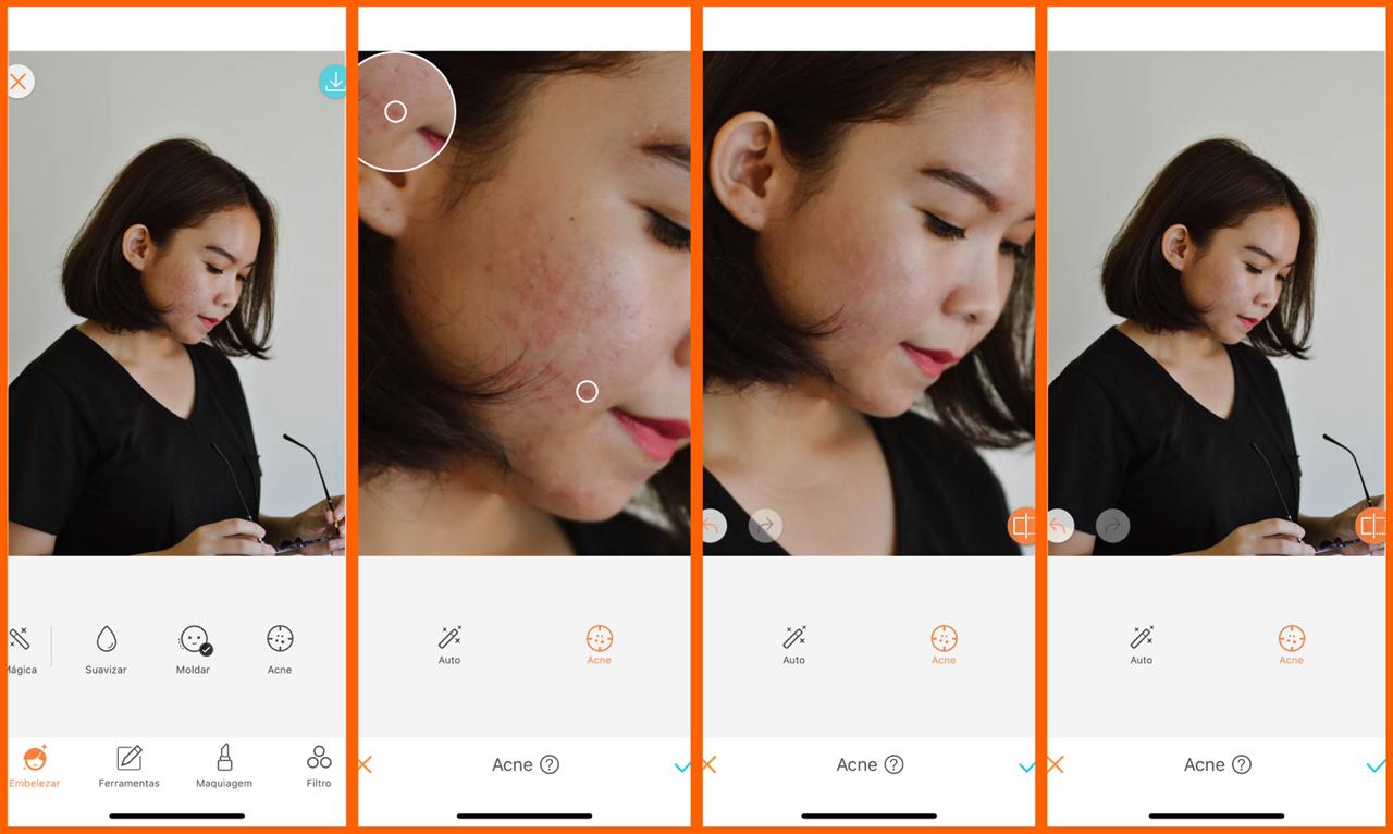 skin care digital ferramenta acne
